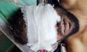 চার হাত-পায়ের রগ কাটার পর অটোচালকের দুচোখ উপড়ে ফেলার অভিযোগ