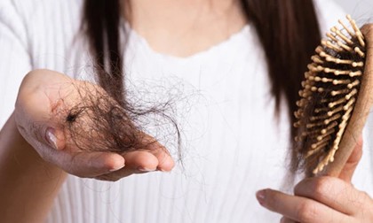 যে ভিটামিনের অভাবে বাড়তে পারে চুল পড়া